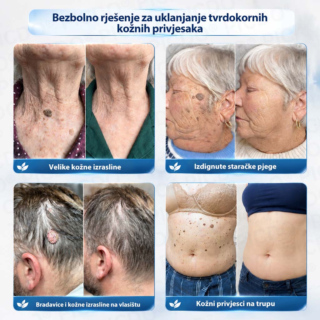 𝑷𝒊𝒄𝒅𝒐® 7-𝒅𝒏𝒆𝒗𝒏𝒂 𝒌𝒓𝒆𝒎𝒂 𝒛𝒂 𝒌𝒐ž𝒏𝒆 𝒊𝒛𝒓𝒂𝒔𝒍𝒊𝒏𝒆 𝒊 𝒑𝒊𝒈𝒎𝒆𝒏𝒕𝒂𝒄𝒊𝒋𝒔𝒌𝒆 𝒎𝒓𝒍𝒋𝒆 ✅ (𝒃𝒆𝒛𝒃𝒐𝒍𝒏𝒂 𝒇𝒐𝒓𝒎𝒖𝒍𝒂, 𝒃𝒆𝒛 𝒐𝒔𝒕𝒂𝒗𝒍𝒋𝒂𝒏𝒋𝒂 𝒐ž𝒊𝒍𝒋𝒂𝒌𝒂) ✨