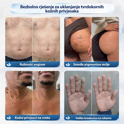 𝑷𝒊𝒄𝒅𝒐® 7-𝒅𝒏𝒆𝒗𝒏𝒂 𝒌𝒓𝒆𝒎𝒂 𝒛𝒂 𝒌𝒐ž𝒏𝒆 𝒊𝒛𝒓𝒂𝒔𝒍𝒊𝒏𝒆 𝒊 𝒑𝒊𝒈𝒎𝒆𝒏𝒕𝒂𝒄𝒊𝒋𝒔𝒌𝒆 𝒎𝒓𝒍𝒋𝒆 ✅ (𝒃𝒆𝒛𝒃𝒐𝒍𝒏𝒂 𝒇𝒐𝒓𝒎𝒖𝒍𝒂, 𝒃𝒆𝒛 𝒐𝒔𝒕𝒂𝒗𝒍𝒋𝒂𝒏𝒋𝒂 𝒐ž𝒊𝒍𝒋𝒂𝒌𝒂) ✨