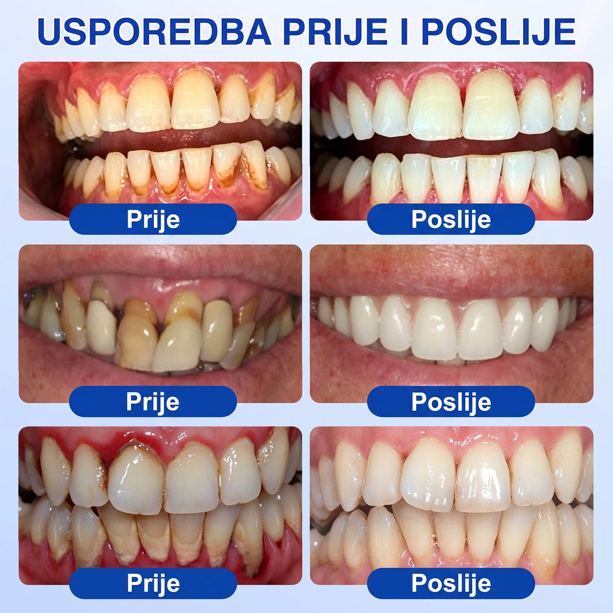 𝑬𝒗𝒐𝒍𝒗𝒊𝒐𝒏® 🦷 𝑮𝒖𝒎𝑹𝒆𝒗𝒊𝒗𝒆 𝒈𝒆𝒍 𝒛𝒂 𝒐𝒃𝒏𝒐𝒗𝒖 𝒑𝒂𝒓𝒐𝒅𝒐𝒏𝒕𝒂 — 𝒛𝒂 𝒛𝒅𝒓𝒂𝒗𝒊𝒋𝒆 𝒅𝒆𝒔𝒏𝒊 𝒊 𝒔𝒂𝒎𝒐𝒑𝒐𝒖𝒛𝒅𝒂𝒏𝒊𝒋𝒊 𝒐𝒔𝒎𝒊𝒋𝒆𝒉🔥