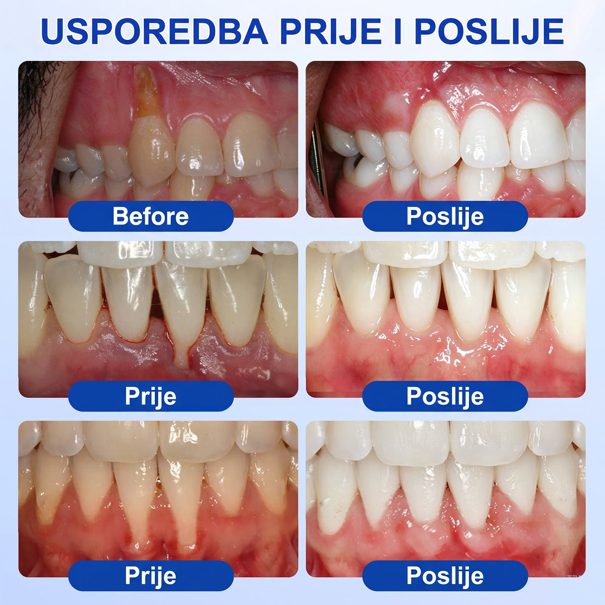 𝑬𝒗𝒐𝒍𝒗𝒊𝒐𝒏® 🦷 𝑮𝒖𝒎𝑹𝒆𝒗𝒊𝒗𝒆 𝒈𝒆𝒍 𝒛𝒂 𝒐𝒃𝒏𝒐𝒗𝒖 𝒑𝒂𝒓𝒐𝒅𝒐𝒏𝒕𝒂 — 𝒛𝒂 𝒛𝒅𝒓𝒂𝒗𝒊𝒋𝒆 𝒅𝒆𝒔𝒏𝒊 𝒊 𝒔𝒂𝒎𝒐𝒑𝒐𝒖𝒛𝒅𝒂𝒏𝒊𝒋𝒊 𝒐𝒔𝒎𝒊𝒋𝒆𝒉🔥