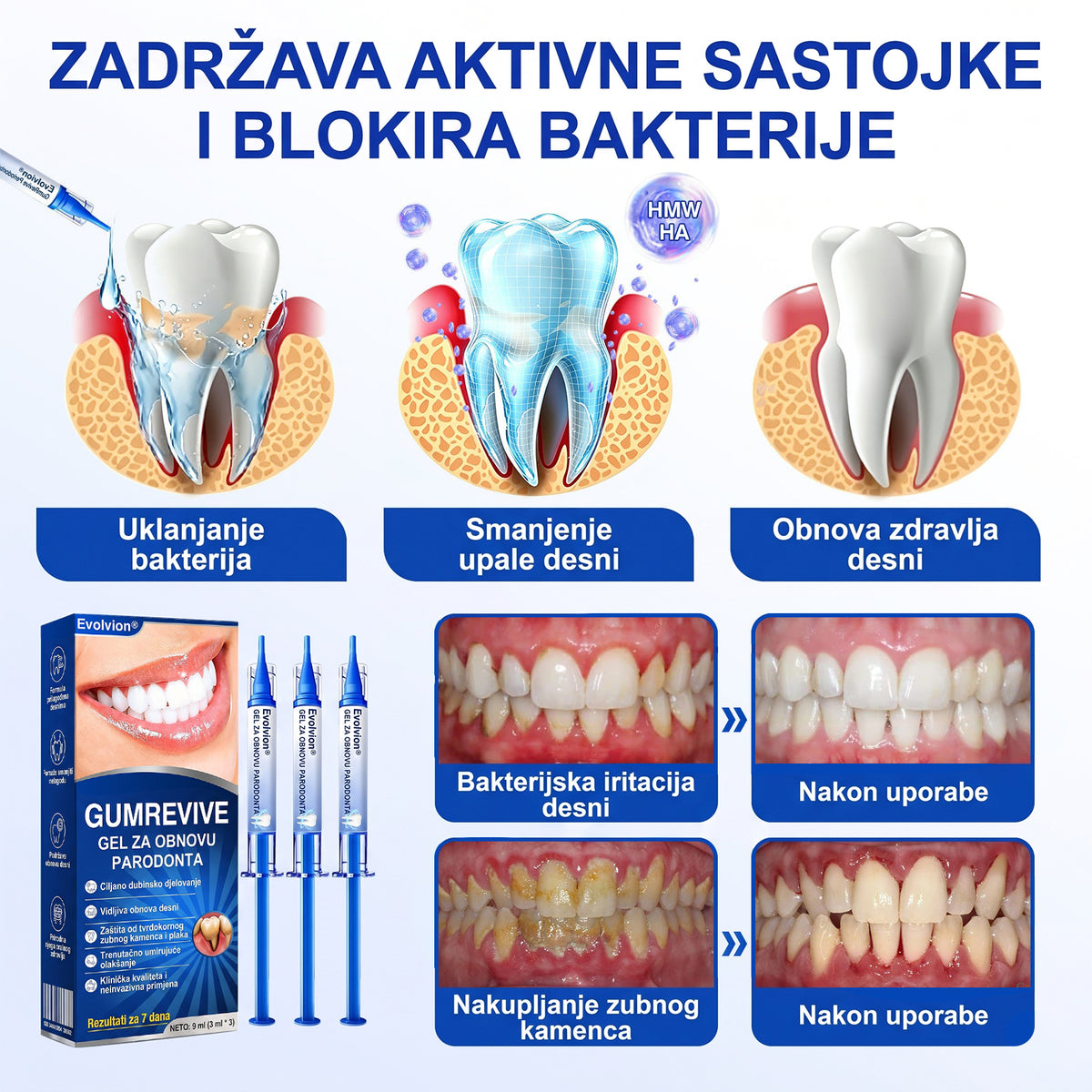 𝑬𝒗𝒐𝒍𝒗𝒊𝒐𝒏® 🦷 𝑮𝒖𝒎𝑹𝒆𝒗𝒊𝒗𝒆 𝒈𝒆𝒍 𝒛𝒂 𝒐𝒃𝒏𝒐𝒗𝒖 𝒑𝒂𝒓𝒐𝒅𝒐𝒏𝒕𝒂 — 𝒛𝒂 𝒛𝒅𝒓𝒂𝒗𝒊𝒋𝒆 𝒅𝒆𝒔𝒏𝒊 𝒊 𝒔𝒂𝒎𝒐𝒑𝒐𝒖𝒛𝒅𝒂𝒏𝒊𝒋𝒊 𝒐𝒔𝒎𝒊𝒋𝒆𝒉🔥