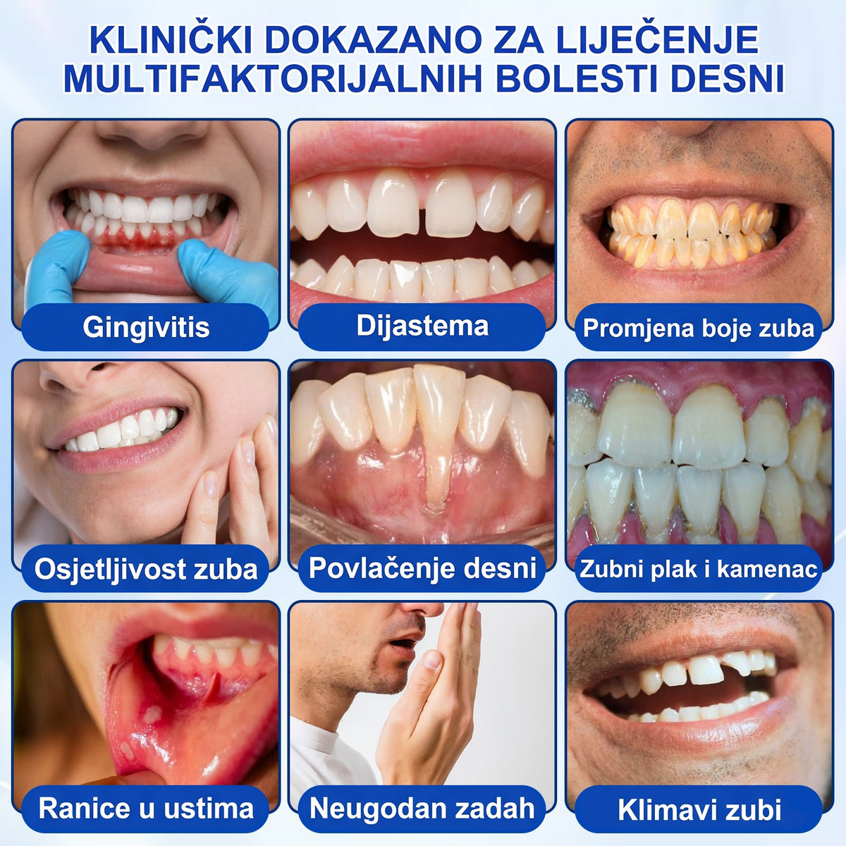 𝑬𝒗𝒐𝒍𝒗𝒊𝒐𝒏® 🦷 𝑮𝒖𝒎𝑹𝒆𝒗𝒊𝒗𝒆 𝒈𝒆𝒍 𝒛𝒂 𝒐𝒃𝒏𝒐𝒗𝒖 𝒑𝒂𝒓𝒐𝒅𝒐𝒏𝒕𝒂 — 𝒛𝒂 𝒛𝒅𝒓𝒂𝒗𝒊𝒋𝒆 𝒅𝒆𝒔𝒏𝒊 𝒊 𝒔𝒂𝒎𝒐𝒑𝒐𝒖𝒛𝒅𝒂𝒏𝒊𝒋𝒊 𝒐𝒔𝒎𝒊𝒋𝒆𝒉🔥