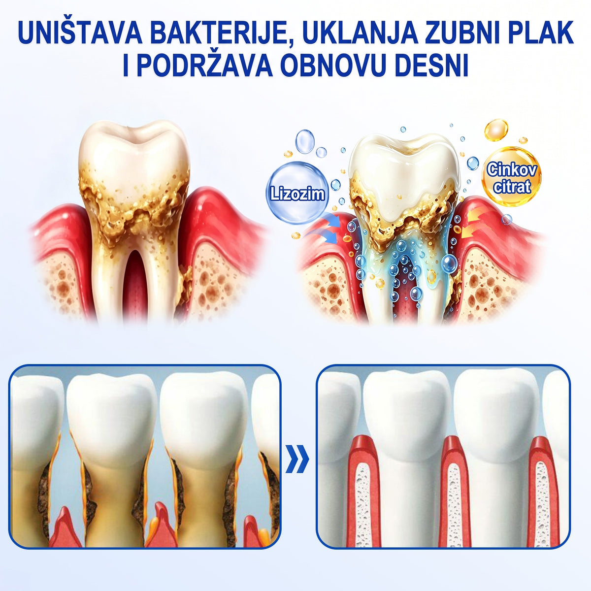 𝑬𝒗𝒐𝒍𝒗𝒊𝒐𝒏® 🦷 𝑮𝒖𝒎𝑹𝒆𝒗𝒊𝒗𝒆 𝒈𝒆𝒍 𝒛𝒂 𝒐𝒃𝒏𝒐𝒗𝒖 𝒑𝒂𝒓𝒐𝒅𝒐𝒏𝒕𝒂 — 𝒛𝒂 𝒛𝒅𝒓𝒂𝒗𝒊𝒋𝒆 𝒅𝒆𝒔𝒏𝒊 𝒊 𝒔𝒂𝒎𝒐𝒑𝒐𝒖𝒛𝒅𝒂𝒏𝒊𝒋𝒊 𝒐𝒔𝒎𝒊𝒋𝒆𝒉🔥