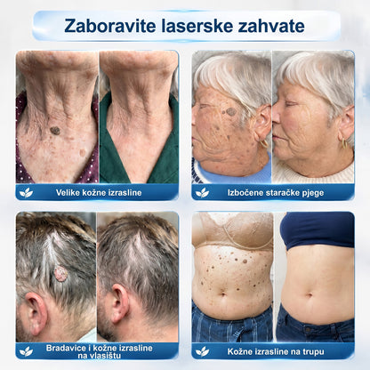 𝑺𝒍𝒖ž𝒃𝒆𝒏𝒂 𝒕𝒓𝒈𝒐𝒗𝒊𝒏𝒂 ✅ | 𝑷𝒊𝒄𝒅𝒐® 7-𝒅𝒏𝒆𝒗𝒏𝒊 𝒐𝒅𝒔𝒕𝒓𝒂𝒏𝒋𝒊𝒗𝒂č 𝒌𝒐ž𝒏𝒊𝒉 𝒊𝒛𝒓𝒂𝒔𝒍𝒊𝒏𝒂 𝒊 𝒑𝒊𝒈𝒎𝒆𝒏𝒕𝒂𝒄𝒊𝒋𝒔𝒌𝒊𝒉 𝒎𝒓𝒍𝒋𝒂 👩‍⚕️ (𝒃𝒆𝒛 𝒃𝒐𝒍𝒊, 𝒃𝒆𝒛 𝒐ž𝒊𝒍𝒋𝒂𝒌𝒂, 𝒑𝒓𝒆𝒄𝒊𝒛𝒏𝒊 𝒓𝒐𝒍𝒍-𝒐𝒏 𝒂𝒑𝒍𝒊𝒌𝒂𝒕𝒐𝒓) ❤️‍🔥