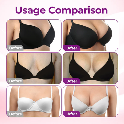 💥Turonu® 💥Targeted Breast Enhancement Advanced Nano Microneedle Patch💥💥💥